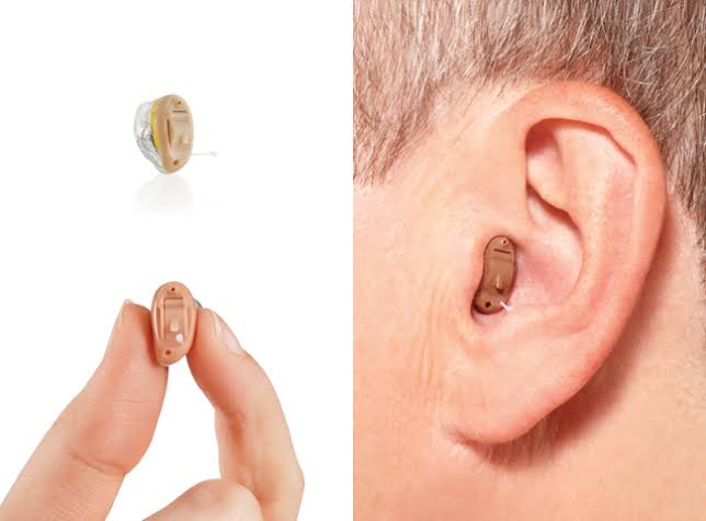 Aide auditive intra